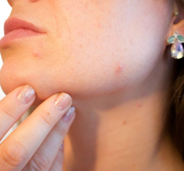 Skin Nutrition Therapies